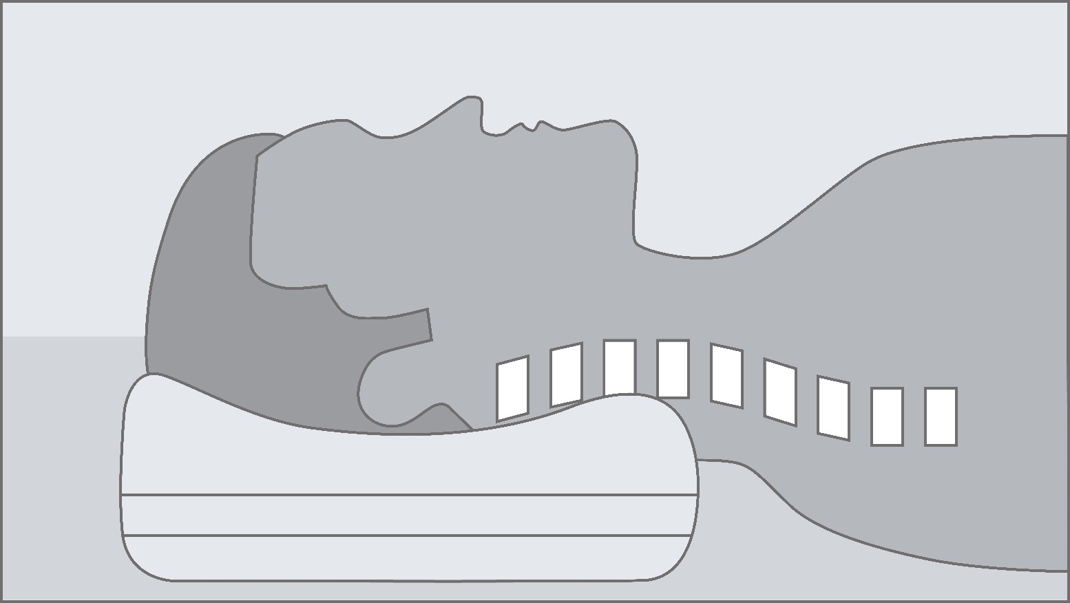 Which cushion is right for me? - Sanders-Kauffmann GmbH